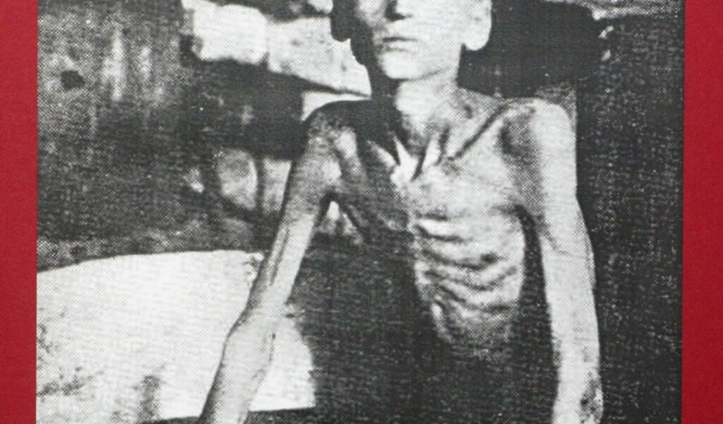 Abmagert bis auf die Knochen: Das Foto zeigt ein Holodomor-Opfer in Charkiw, es entstand 1933.