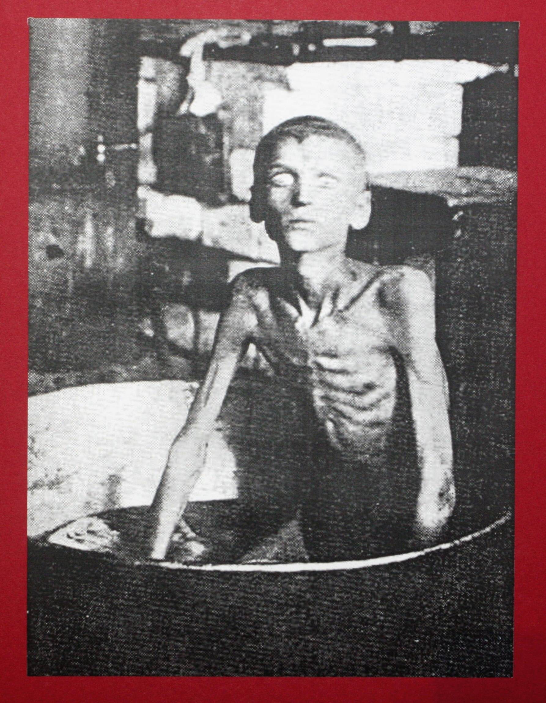 Abmagert bis auf die Knochen: Das Foto zeigt ein Holodomor-Opfer in Charkiw, es entstand 1933.